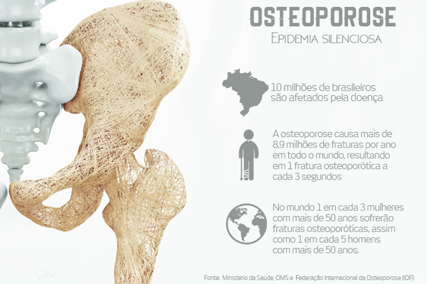 Entenda a diferença entre a Artrose e a Osteoporose